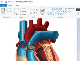 Edi&ccedil;&atilde;o de imagem
